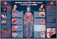 Электрифицированный стенд "Вредные привычки: алкоголизм" - «globural.ru» - Ессентуки