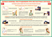 Таблица Порядок действий при опасном кровотечении 1000*1400 винил - «globural.ru» - Ессентуки