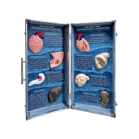 Учебно-демонстрационный кейс "Последствия употребления алкоголя и наркотиков" - «globural.ru» - Ессентуки