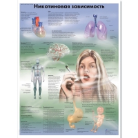 Плакат "Никотиновая зависимость", ламинированный, 50*67 см - «globural.ru» - Ессентуки