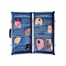 Учебно-демонстрационный кейс "Последствия употребления наркотиков" - «globural.ru» - Ессентуки