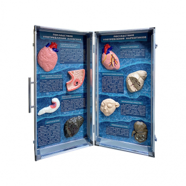 Учебно-демонстрационный кейс "Последствия употребления алкоголя и наркотиков" - «globural.ru» - Ессентуки